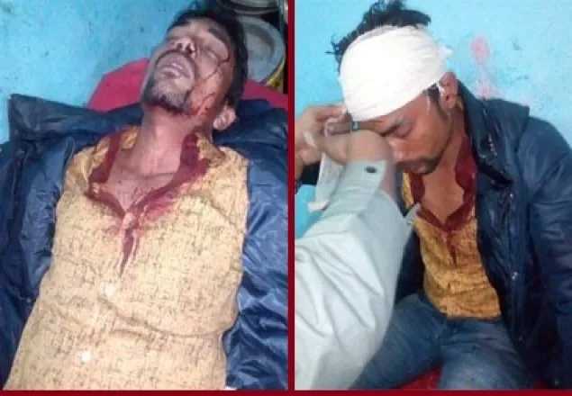 মির্জা ফখরুলের পোষ্টার ছেঁড়াকে কেন্দ্র করে সংঘর্ষ 