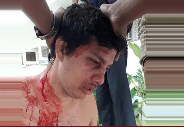 মওদুদের গণসংযোগে অস্ত্র’সহ ছাত্রলীগের হামলা 