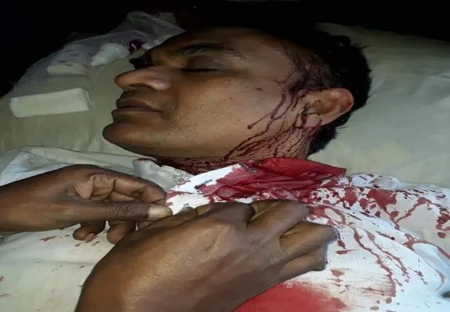 শরীয়তপুরে-৩ বিএনপি প্রার্থীকে কুপিয়ে জখম, চিকিৎসা নিতেও বাধা