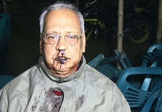 উঠান বৈঠকে হামলা, রক্তাক্ত বিএনপির প্রার্থী মেজর আখতারুজ্জামান