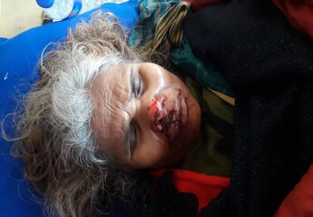 গাইবান্ধায় প্রতিপক্ষের হামলায় মা-ছেলে আহত