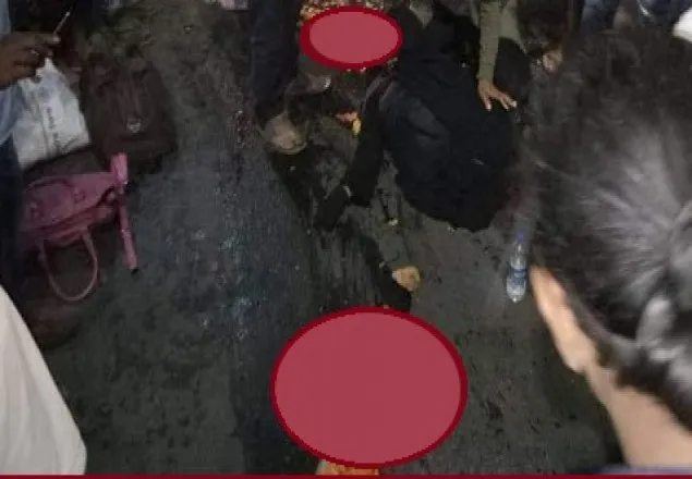 বাড্ডায় ট্রাকচাপায় নারীর ২ পা কোমর থেকে বিচ্ছিন্ন