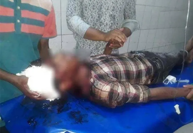 চট্টগ্রামে মুখোশধারীদের হামলায় ৩ স্কুল শিক্ষার্থী আহত