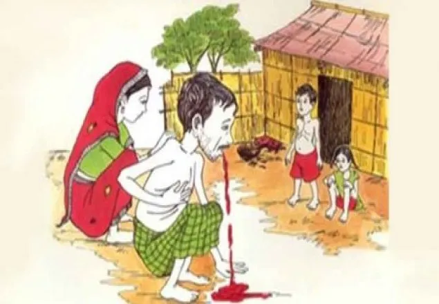 বিশ্ব যক্ষ্মা দিবস আজ