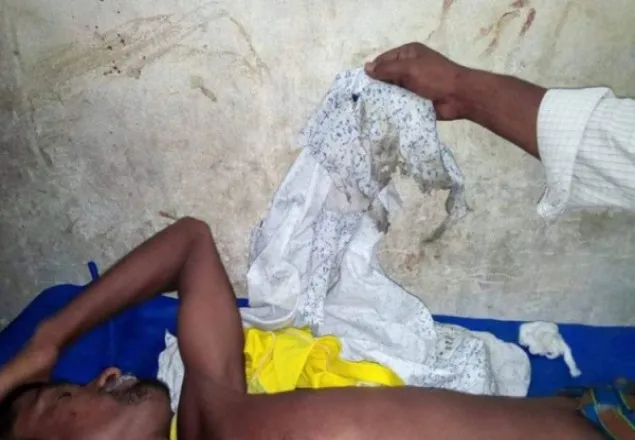 বরগুনায় আ. লীগ প্রার্থীর জনসভায় বোমা হামলা, আহত ২০