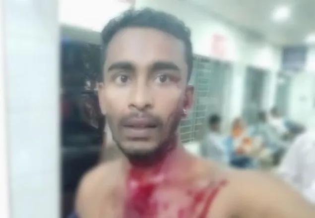 ডাকসু, স্বতন্ত্র প্রার্থী হওয়ায় ছাত্রলীগের মারধর