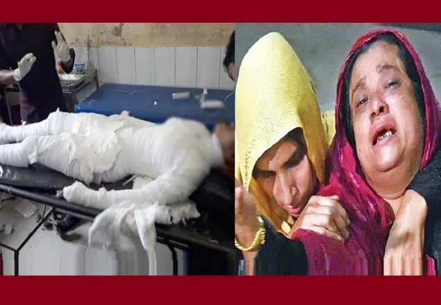 আলিম পরীক্ষার্থী নুসরাতের ৮০ শতাংশ দগ্ধ, পুড়েছে শ্বাসনালিও