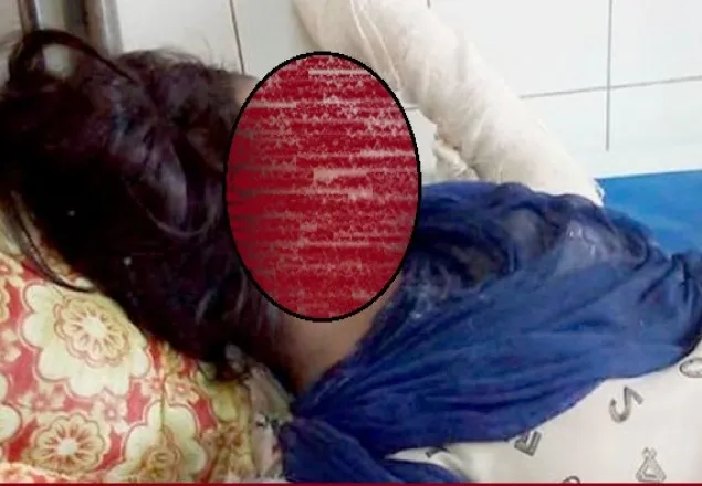 নরসিংদীতে একই পরিবারের ৪ জন অগ্নিদগ্ধ