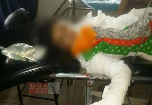 ফেনীতে অগ্নিদগ্ধ সেই মাদ্রাসাছাত্রীর মৃত্যু