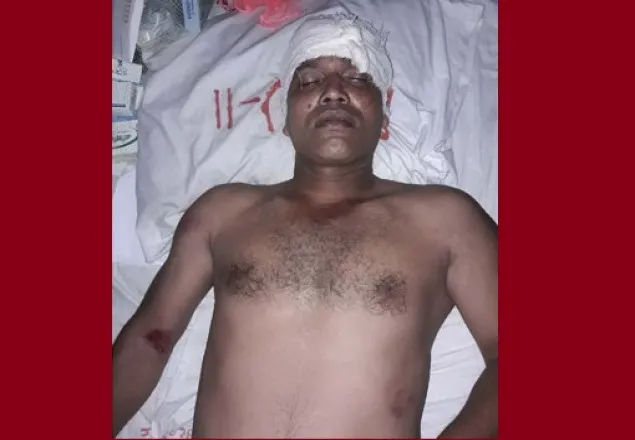 বরিশালে যুবলীগ নেতার দু’পায়ের রগ কাটলো আ’লীগ নেতা 