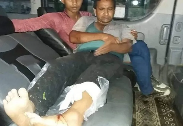 চট্টগ্রামে দুর্বৃত্তদের হামলায় পা ভাঙলো সাংবাদিকের