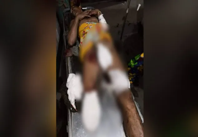 কালা মিয়ার পা কেটে নিলো স্বেচ্ছাসেবক লীগ নেতা!