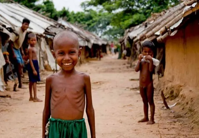 পুষ্টিহীনতায় ১০ শতাংশ মানুষ 