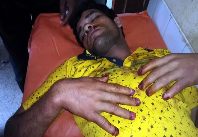 বাংলাদেশি যুবকের হাতের সব নখ তুলে ফেলেছে ভারতের বিএসএফ