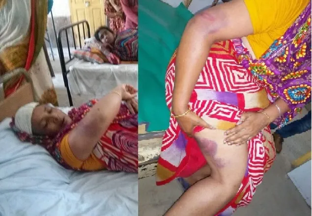 পাটগ্রামে ইউপি চেয়ারম্যানের বিরুদ্ধে গৃহবধুকে মারধরের অভিযোগ