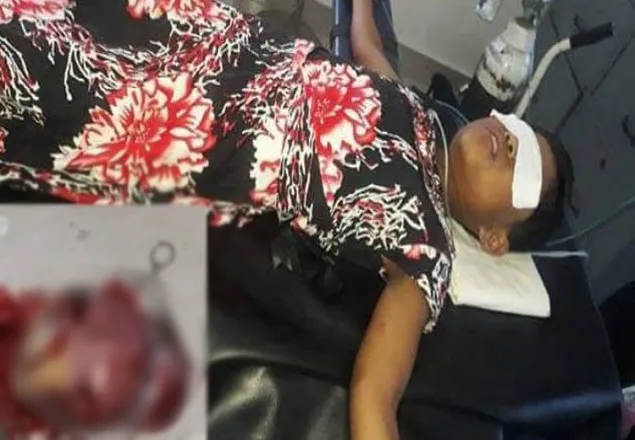 শিশুর পেটের চারকেজি টিউমারের ভেতর আরেক শিশু!