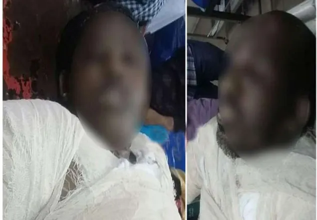 রাজধানীতে টেলিভিশন বিস্ফোরণে দম্পতি দগ্ধ