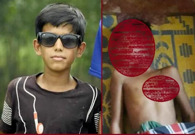 হবিগঞ্জে মোবাইল বিস্ফোরণে শিশুর মৃত্যু 
