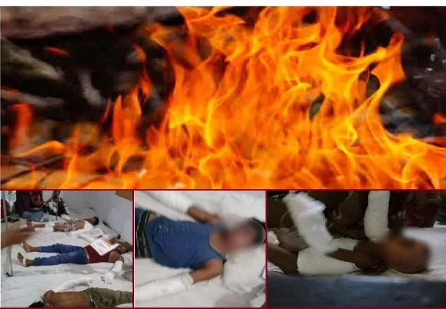 কাভার্ডভ্যানের ধাক্কায় মাইক্রোবাসের সিলিন্ডার বিস্ফোরণ, নারী-শিশুসহ দগ্ধ ২০