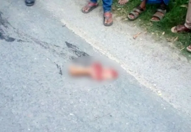 রাজশাহীতে বেপরোয়া ট্রাক বিচ্ছিন্ন করে দিল শিক্ষার্থীর হাত