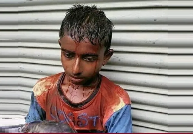আইসিইউতে সেই অটোরিকশার চালক শাহীন