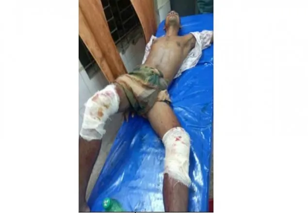 লালমনিরহাটে ‘বন্দুকযুদ্ধে’ যুবক গুলিবিদ্ধ