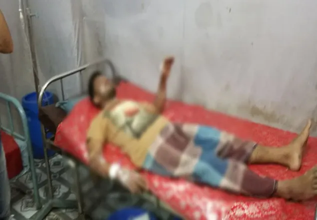 গাজীপুরে কারখানায় অগ্নিকাণ্ড, দগ্ধ ৮