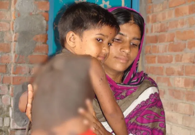 পশুর মত লোমে ঢেকে যাচ্ছে তাসফিয়ার শরীর