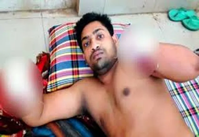 চাঁপাইনবাবগঞ্জে যুবকের দুই হাতের কব্জি কেটে নিল প্রতিপক্ষ