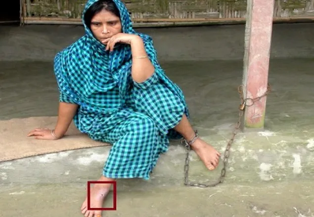  ৮ বছর ধরে শেকলে বাঁধা করসিনার জীবন!