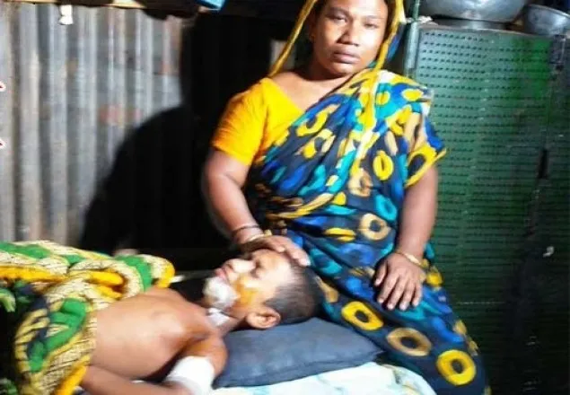 টাকার অভাবে কাতরাচ্ছে গ্যাস সিলিন্ডার বিস্ফোরণে আহত শাহীন