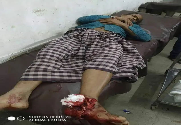 গাইবান্ধায় পুলিশের সাথে বন্দুকযুদ্ধে ২ ডাকাত গুলিবিদ্ধ
