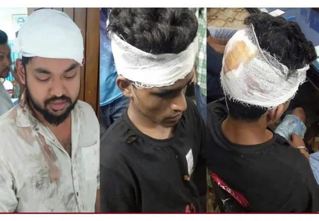 মারধরের ঘটনায় জবির ৪ শিক্ষার্থী গুরুতর আহত