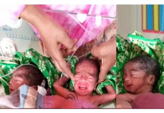 মাগুরায় আবারও একইসঙ্গে তিন সন্তানের জন্ম!