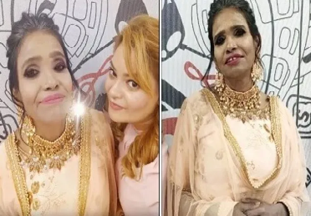 রানু মন্ডল প্লাস্টিক সার্জারি করিয়েছে!