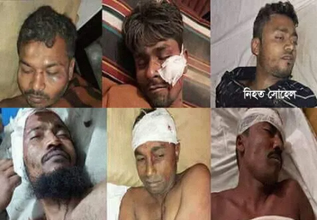 লক্ষ্মীপুরে ডাকাতিকালে গণপিটুনিতে নিহত ১, আহত ৫