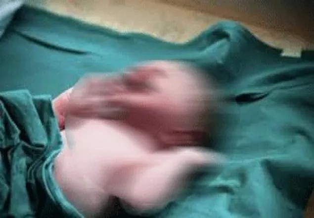 মায়ের গর্ভেই ‘গর্ভবতী’ নবজাতক কন্যা