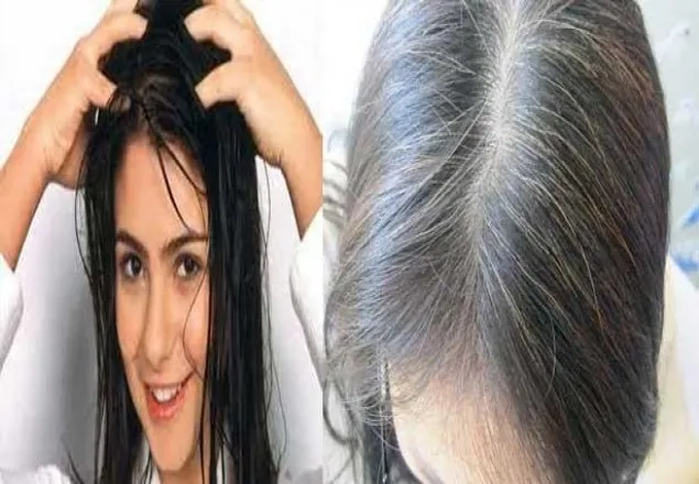 অল্প বয়সেই চুল পাকা রোধে ৫ সমাধান
