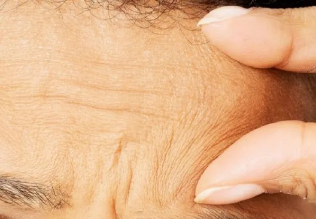 দ্রুত বার্ধক্য রোধে করনীয়