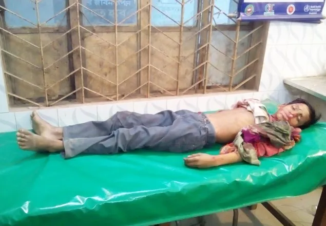 বিরামপুরে গাছের গুল পড়ে শিশু নিহত  