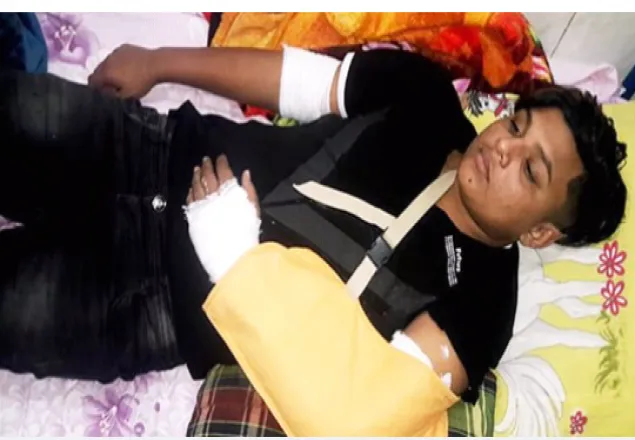 শরীয়তপুরে ছাত্রলীগ নেতার হাতুড়ির আঘাতে হাত ভাঙল কলেজছাত্রের