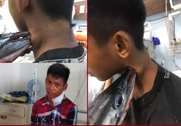 পানি থেকে লাফিয়ে উঠে কিশোরের ঘাড়ে বিধঁলো মাছ