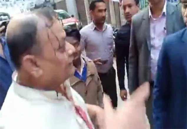 হামলায় রক্তাক্ত বিএনপির এজেন্ট