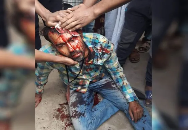  হামলায় রক্তাক্ত সাংবাদিক সুমন