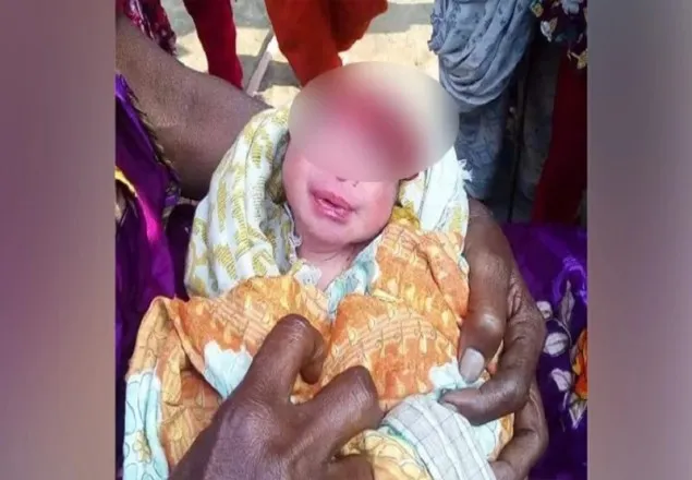 অদ্ভুত আকৃতির শিশুর জন্ম নিয়েছে ঝিনাইদহে