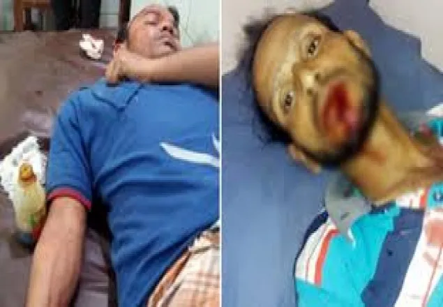 সাতকানিয়ায় প্রতিপক্ষের হামলায় নারীসহ আহত ১০