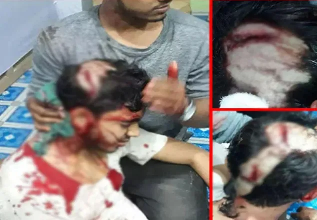 করোনা সচেতনতামূলক পোস্টারিংয়ের সময় শিবিরের উপর ছাত্রলীগের হামলার নিন্দা