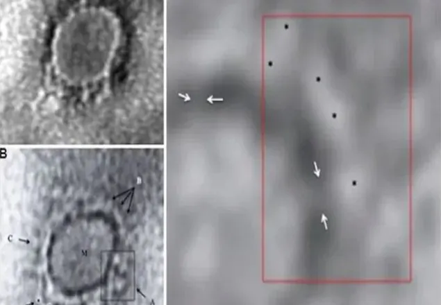  অনুবীক্ষণ যন্ত্রে ধরা পড়ল করোনাভাইরাসের ছবি