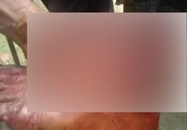 প্রতিপক্ষের পা কেটে বিজয় উল্লাস, আহত অর্ধশত