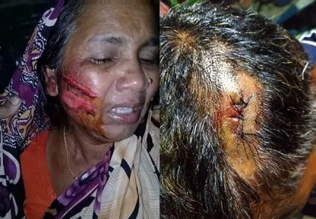  মাগুরার শ্রীপুরে আ.লীগের দু'গ্রুপের সংঘর্ষ 